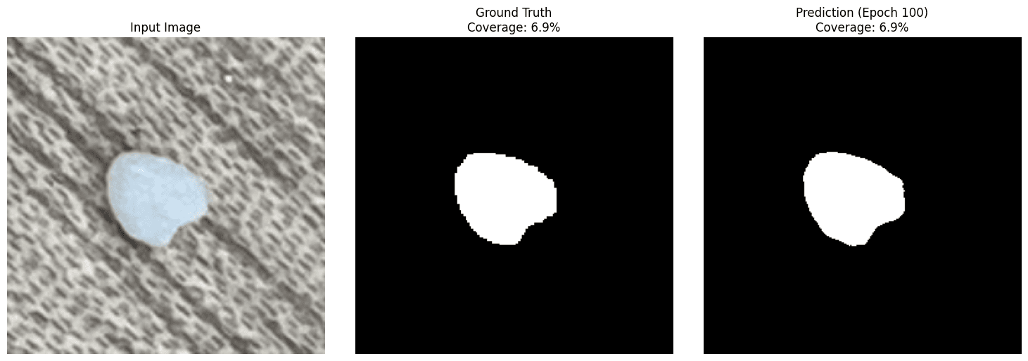 MicroUNet segmentation at epoch 100 — input, ground truth mask, and model prediction