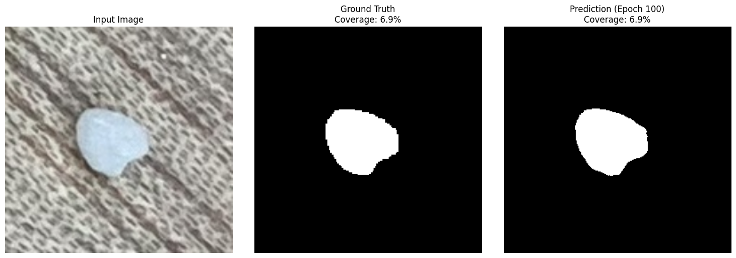 MicroUNet segmentation at epoch 100 — input, ground truth mask, and model prediction